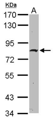 Western Blot: ZNF326 Antibody [NBP2-20992]