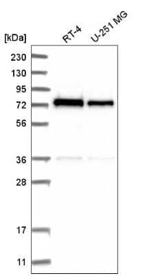 Western Blot: ZNF326 Antibody [NBP2-55094]