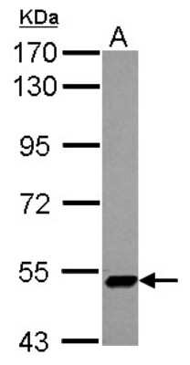 Western Blot: ZNF329 Antibody [NBP2-20993]