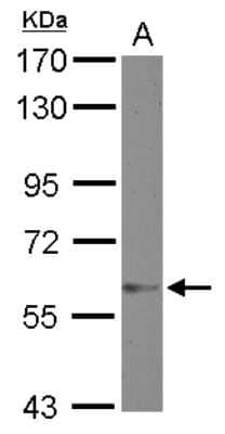 Western Blot: ZNF329 Antibody [NBP2-20994]