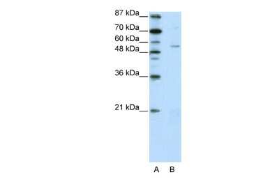 Western Blot: ZNF329 Antibody [NBP2-88668]