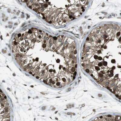 Immunohistochemistry-Paraffin: ZNF330 Antibody [NBP1-81694]