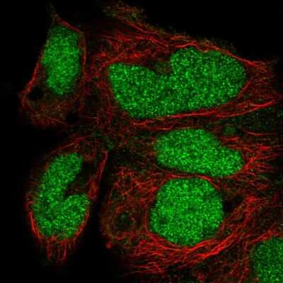 Immunocytochemistry/ Immunofluorescence: ZNF331 Antibody [NBP2-55808]