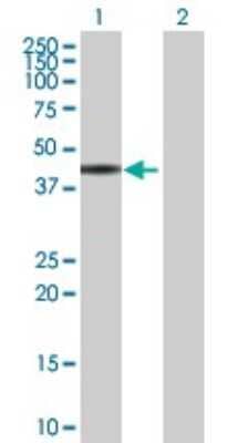 Western Blot: ZNF331 Antibody [H00055422-B01P]