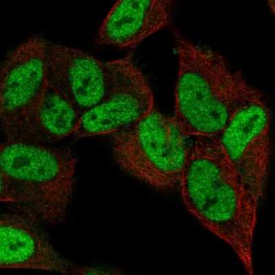 Immunocytochemistry/ Immunofluorescence: ZNF333 Antibody [NBP2-55500]