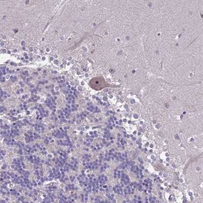 Immunohistochemistry-Paraffin: ZNF333 Antibody [NBP1-92623]