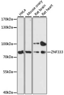 Western Blot: ZNF333 AntibodyAzide and BSA Free [NBP2-94717]