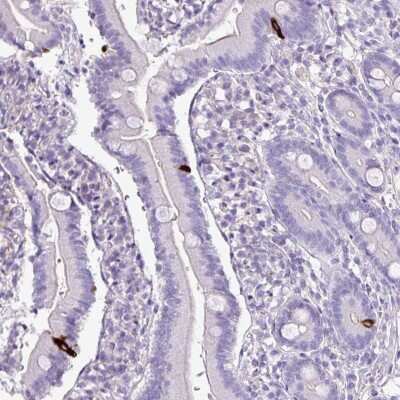 Immunohistochemistry-Paraffin: ZNF334 Antibody [NBP2-13567]