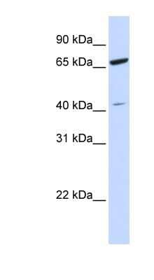 Western Blot: ZNF334 Antibody [NBP1-79707]