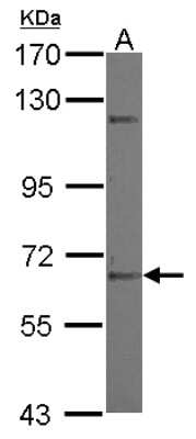 Western Blot: ZNF334 Antibody [NBP2-20995]