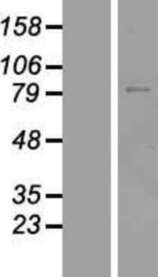 Western Blot: ZNF334 Overexpression Lysate [NBL1-18122]