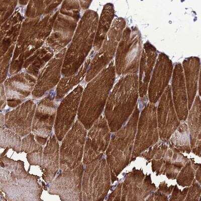 Immunohistochemistry: ZNF336 Antibody [NBP1-92624]