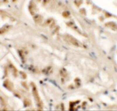 Immunohistochemistry: ZNF336 Antibody - BSA Free [NBP2-81879]