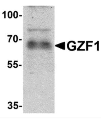 Western Blot: ZNF336 AntibodyBSA Free [NBP2-81879]