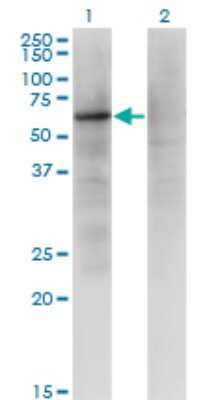 Western Blot: ZNF34 Antibody (1B11) [H00080778-M03]