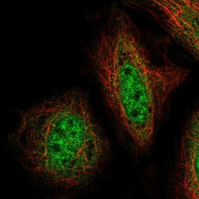 Immunocytochemistry/ Immunofluorescence: ZNF34 Antibody [NBP2-56197]