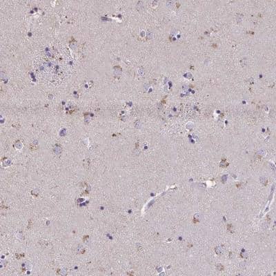 Immunohistochemistry-Paraffin: ZNF34 Antibody [NBP2-32564]