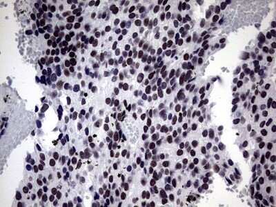 Immunohistochemistry: ZNF34 Antibody (OTI3G2) - Azide and BSA Free [NBP2-74937]