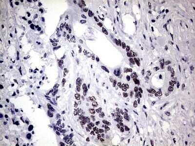 Immunohistochemistry: ZNF34 Antibody (OTI3G2) - Azide and BSA Free [NBP2-74937]