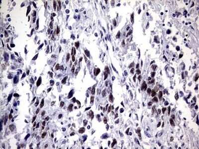 Immunohistochemistry: ZNF34 Antibody (OTI3G2) - Azide and BSA Free [NBP2-74937]