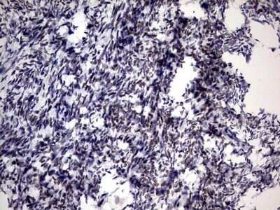 Immunohistochemistry: ZNF34 Antibody (OTI3G2) - Azide and BSA Free [NBP2-74937]