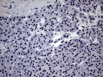 Immunohistochemistry: ZNF34 Antibody (OTI3G2) - Azide and BSA Free [NBP2-74937]