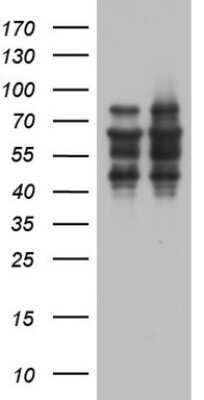 Western Blot: ZNF34 Antibody (OTI3G2)Azide and BSA Free [NBP2-74937]