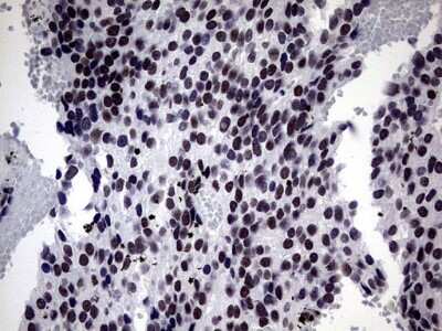 Immunohistochemistry: ZNF34 Antibody (OTI3G2) [NBP2-46433]