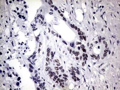 Immunohistochemistry: ZNF34 Antibody (OTI3G2) [NBP2-46433]