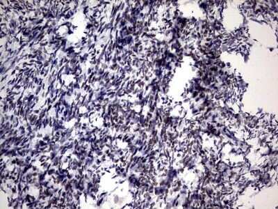 Immunohistochemistry: ZNF34 Antibody (OTI3G2) [NBP2-46433]