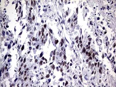 Immunohistochemistry: ZNF34 Antibody (OTI3G2) [NBP2-46433]
