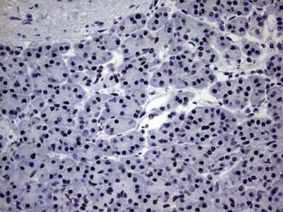 Immunohistochemistry: ZNF34 Antibody (OTI3G2) [NBP2-46433]