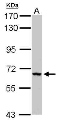 Western Blot: ZNF34 Antibody [NBP2-15172]