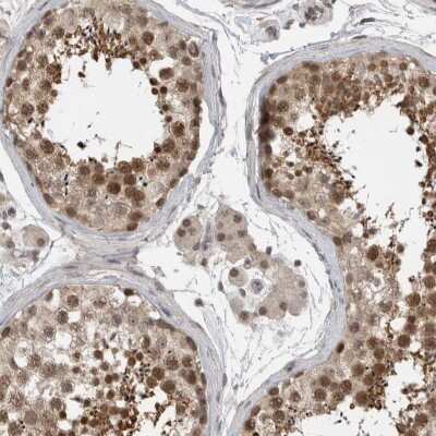 Immunohistochemistry-Paraffin: ZNF341 Antibody [NBP1-84218]