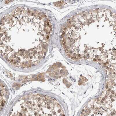 Immunohistochemistry-Paraffin: ZNF341 Antibody [NBP1-84219]