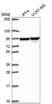 Western Blot: ZNF341 Antibody [NBP2-57823]