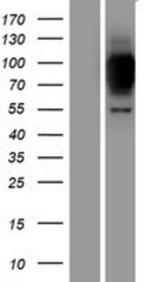 Western Blot: ZNF341 Overexpression Lysate [NBP2-05972]