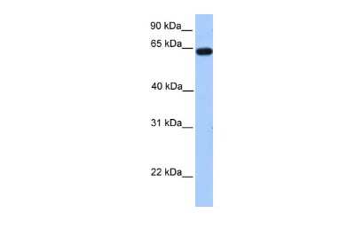 Western Blot: ZNF342 Antibody [NBP2-88675]