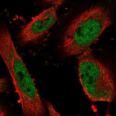 Immunocytochemistry/ Immunofluorescence: ZNF343 Antibody [NBP2-57101]