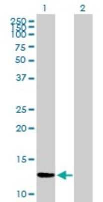 Western Blot: ZNF343 Antibody [H00079175-B01P]