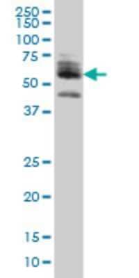 Western Blot: ZNF345 Antibody (6G10) [H00025850-M01]