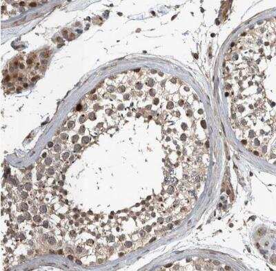 Immunohistochemistry-Paraffin: ZNF345 Antibody [NBP1-81635]