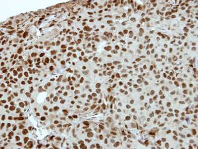 Immunohistochemistry-Paraffin: ZNF345 Antibody [NBP2-20996]