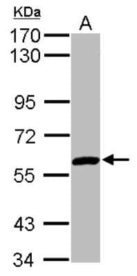 Western Blot: ZNF345 Antibody [NBP2-20996]