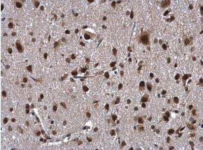 Immunohistochemistry-Paraffin: ZNF346 Antibody [NBP1-32927]