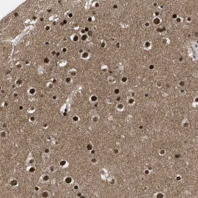 Immunohistochemistry-Paraffin: ZNF346 Antibody [NBP1-83084]