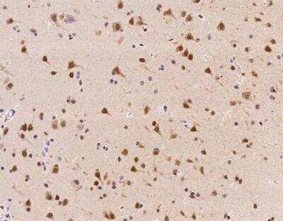 Immunohistochemistry-Paraffin: ZNF346 Antibody [NBP3-12616]