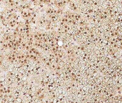 Immunohistochemistry-Paraffin: ZNF346 Antibody [NBP3-12616]