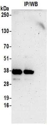 Immunoprecipitation: ZNF346 Antibody [NBP2-32230]