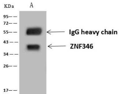 Immunoprecipitation: ZNF346 Antibody [NBP3-12616]
